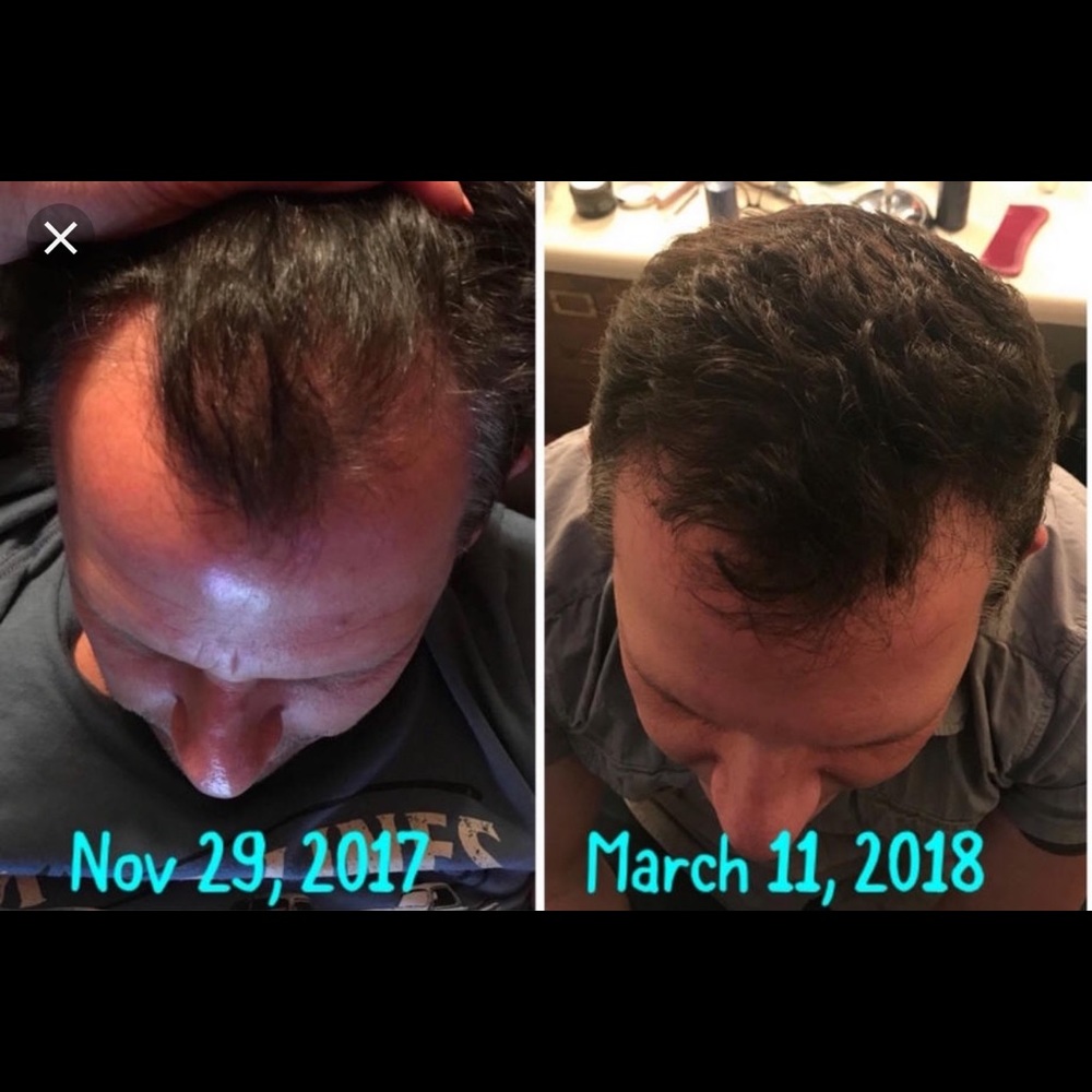 MONAT Samples - Picture 4 of 4